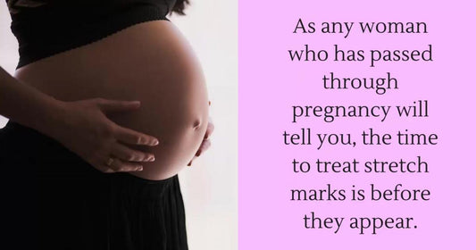  Avoid Stretch Marks During Pregnancy 
